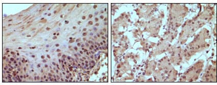 Monoclonal Mouse anti-Human RB1 / Retinoblastoma / RB Antibody (clone 7E4B8, IHC)