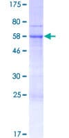 Human RFPL2 Protein (Recombinant GST)