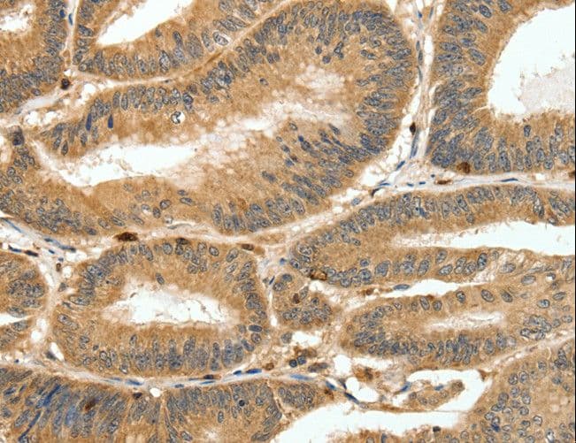 S100A4 / FSP1 Antibody