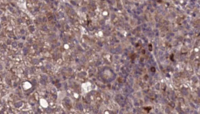 ITGAL / CD11a Antibody