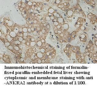 ANKRA2 / ANKRA Antibody (aa50-271)