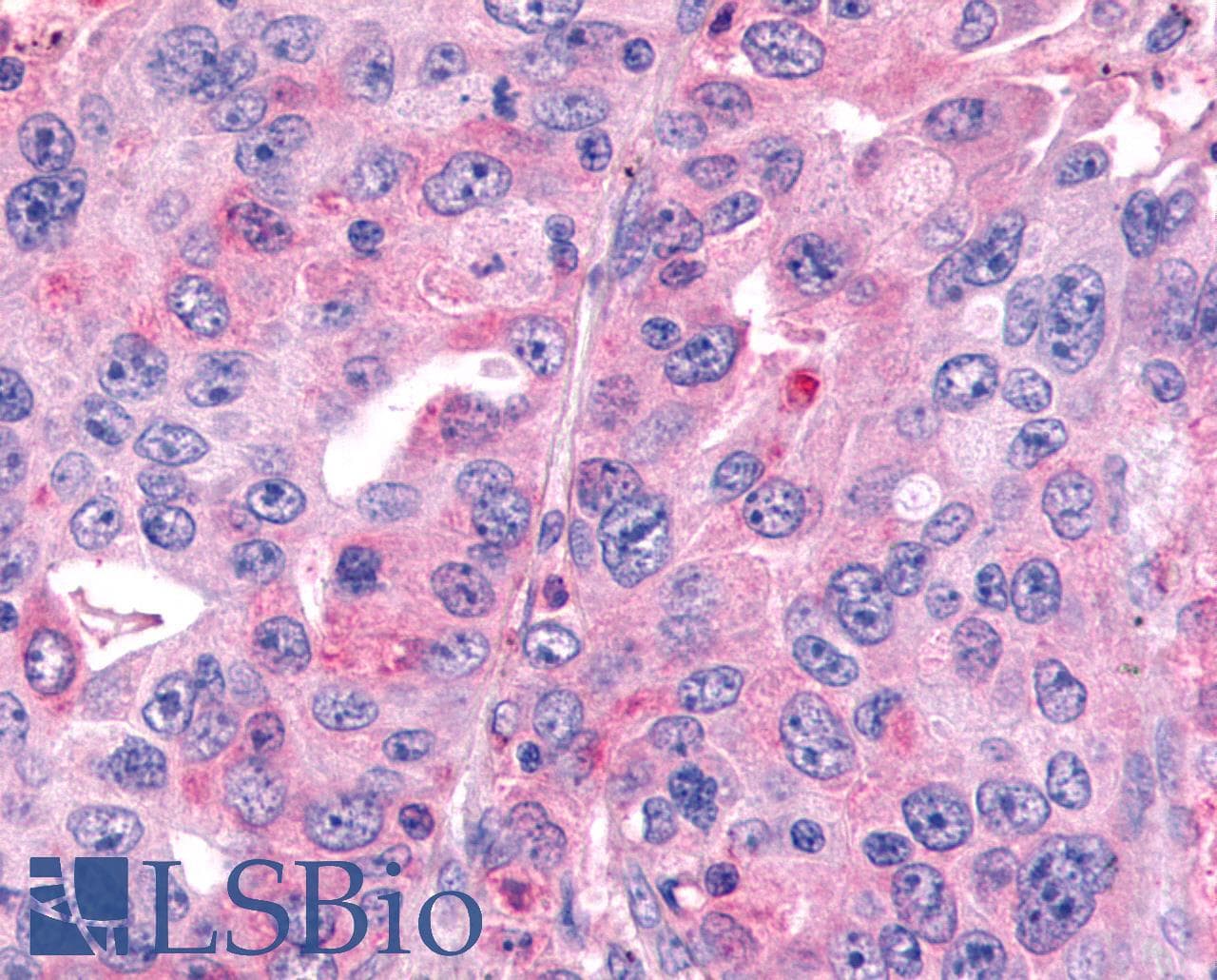 PathPlus™ Polyclonal Rabbit anti-Human FZD7 / Frizzled 7 Antibody (N-Terminus, IHC)
