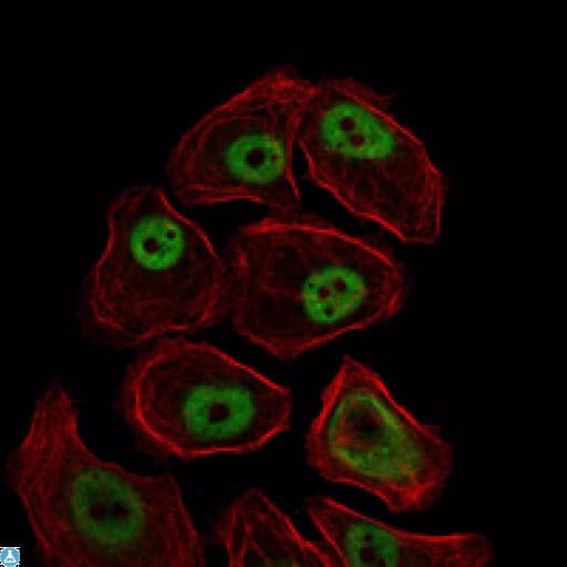SMC1A / SMC1 Antibody