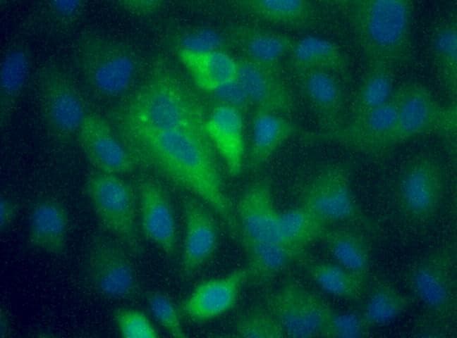 SQSTM1 Antibody (aa400-450, DY488)