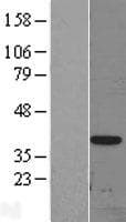 DLX3 Protein (Over-Expression Lysate Myc-DDK (Flag))