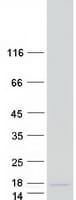 Human SF3B5 Protein (Recombinant Myc-DDK (Flag))