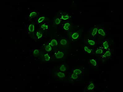 Polyclonal Rabbit anti-Human HIST1H2BN Antibody (IHC, IF)