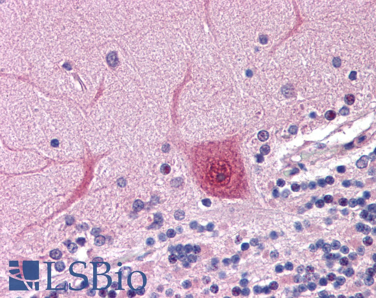 IHC-plus™ Polyclonal Rabbit anti-Human ACTR2 / ARP2 Antibody (IHC, WB)