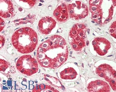 IHC-plus™ RICTOR Antibody (aa1650-C-term)