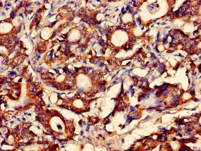 Polyclonal Rabbit anti-Human FAM168B Antibody (IHC)