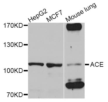 ACE / CD143 Antibody