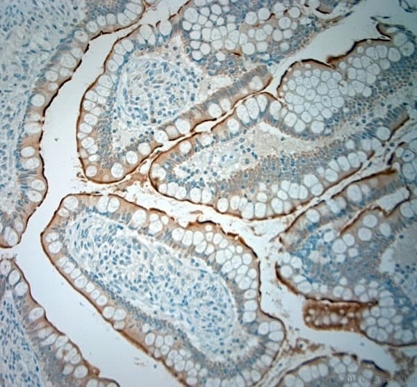 SLC5A8 / AIT Antibody (aa560-610)