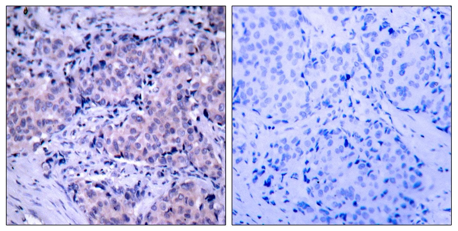 PDPK1 / PDK1 Antibody (p241)