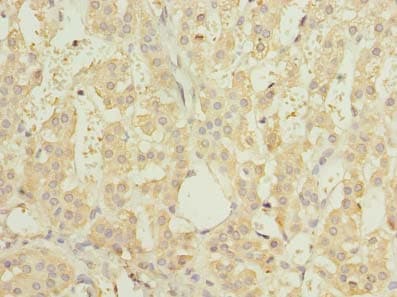 RNF138 Antibody