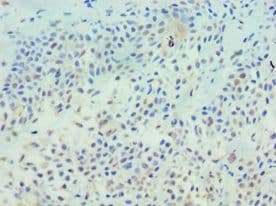 PathPlus™ TFF1 / pS2 Antibody (aa25-84)
