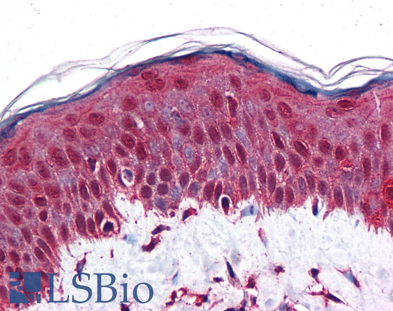 IHC-plus™ RBBP8 / CTIP Antibody