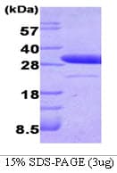 Human Latexin / MUM Protein (Recombinant)