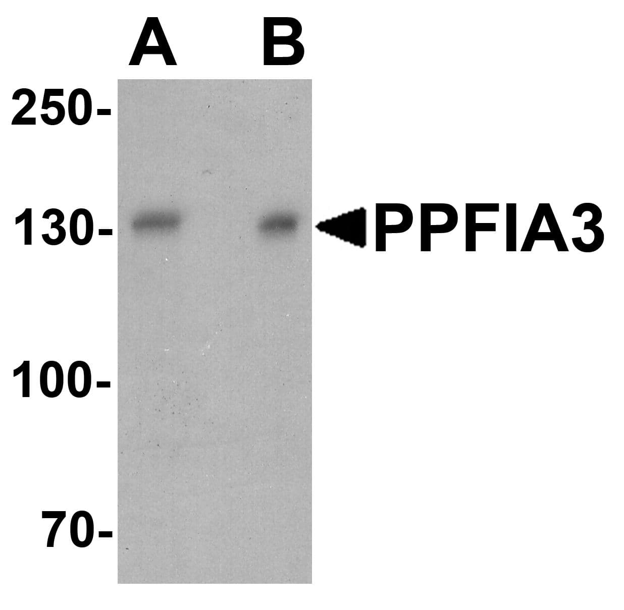 IHC-plus™ Polyclonal Rabbit anti-Human PPFIA3 Antibody (IHC, WB)