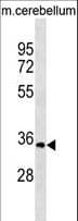 UCK1 Antibody (aa231-260)