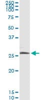 NIX / BNIP3L Antibody (clone 2E11)