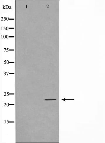 TNFAIP8 / SCC-S2 Antibody