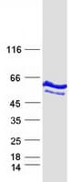 Human WARS Protein (Recombinant Myc-DDK (Flag))