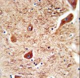 Coronin 7 / CORO7 Antibody (aa173-202)