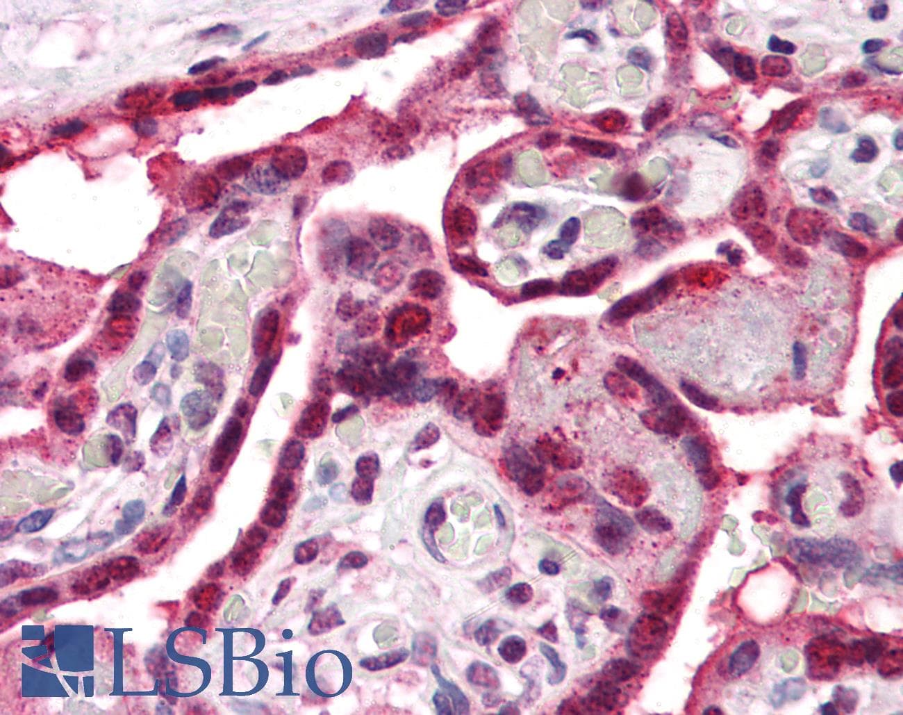 IHC-plus™ Polyclonal Rabbit anti-Human SLC29A1 / ENT1 Antibody (Internal, IHC)
