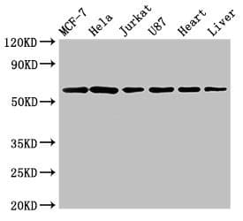 SOCS7 / SOCS-7 Antibody