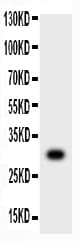 MMP7 / Matrilysin Antibody (aa95-264)
