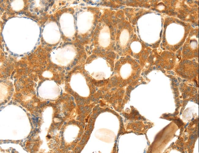 TM7SF2 Antibody