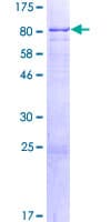 Human ASH2L / ASH2 Protein (Recombinant GST)