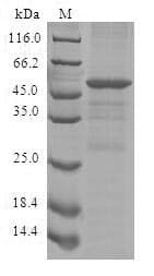 Human CISH / SOCS Protein (Recombinant GST, N-terminus)