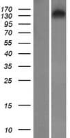 SYNRG Protein (Over-Expression Lysate Myc-DDK (Flag))