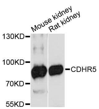 CDHR5 / MUCDHL Antibody