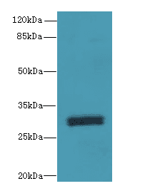 Polyclonal Rabbit anti-Human OVOL1 Antibody (IHC, WB)