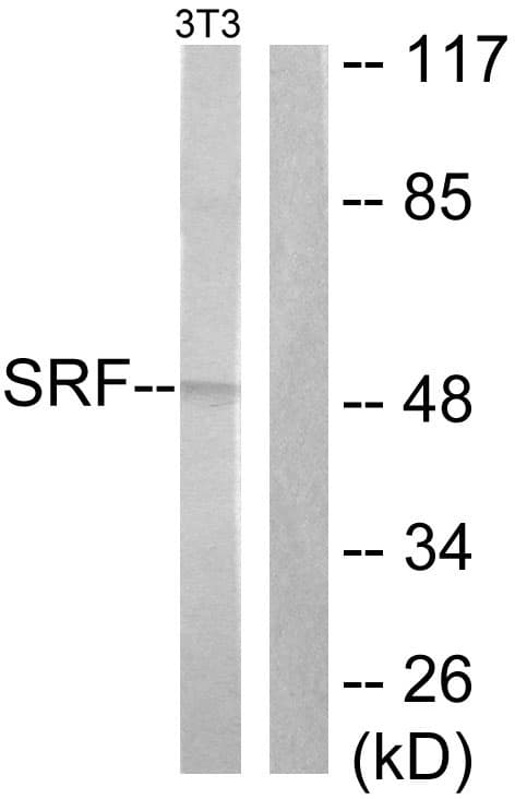 IHC-plus™ SRF / Serum Response Factor Antibody (aa71-120)
