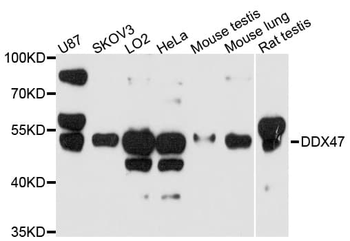 Polyclonal Rabbit anti-Human DDX47 Antibody (WB)