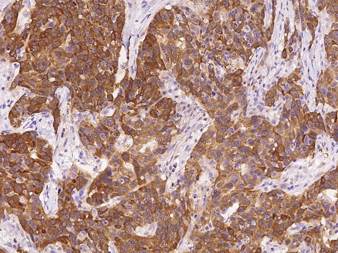 PHGDH Antibody