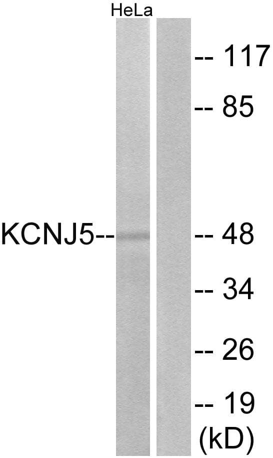 KCNJ5 / Kir3.4 / GIRK4 Antibody