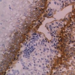 ITGB4 / Integrin Beta 4 Antibody (clone 450-9D, Preservative Free)