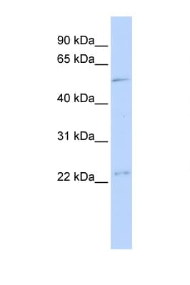 TFDP1 Antibody (C-Terminus)