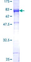 Human KIAA0368 / ECM29 Protein (Recombinant GST)