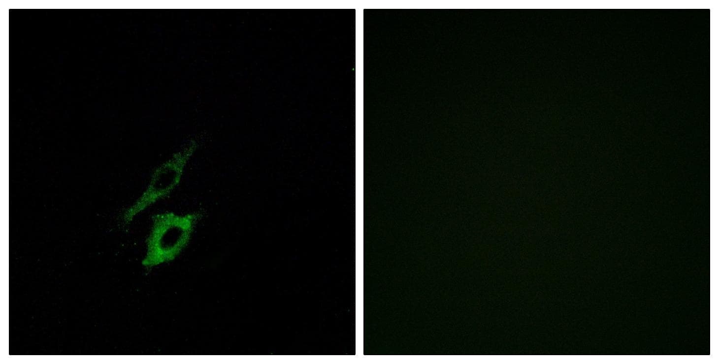 FPR1 / FPR Antibody