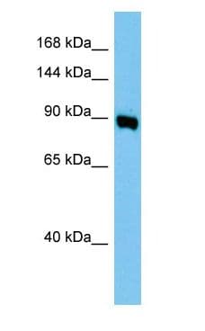 Polyclonal Rabbit anti-Mouse AP1G1 / Adaptin Gamma 1 Antibody (aa641-690, WB)