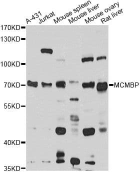 MCMBP / C10orf119 Antibody