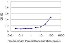 IHC-plus™ CTSD / Cathepsin D Antibody (clone 3F12-1B9)
