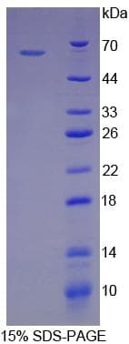 Human HSPD1 / HSP60 Protein (Recombinant His)