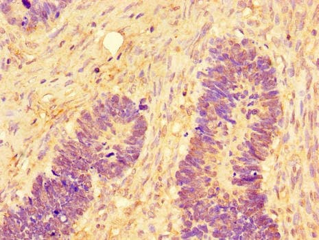 MAPK8 / JNK1 Antibody