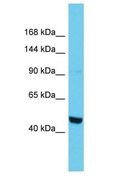 Polyclonal Rabbit anti-Mouse PTPN14 / PEZ Antibody (aa2-51, WB)